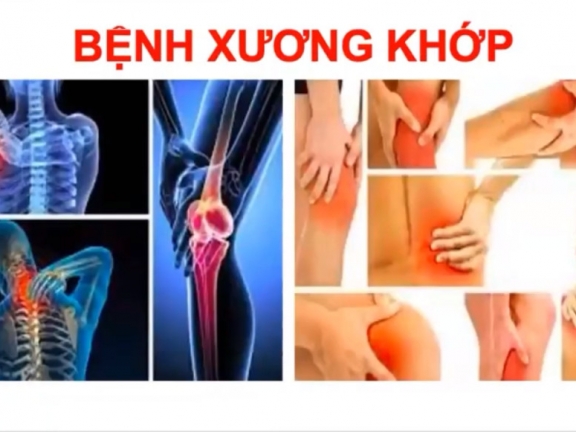 ✅ 03.98 Bệnh xương khớp - Người cao tuổi (tt)