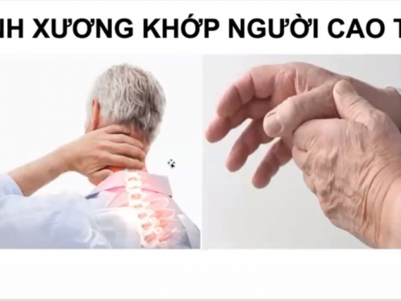 ✅ 03.99 Bệnh xương khớp - Người cao tuổi